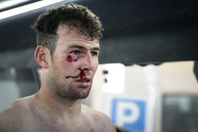 Mark Cavendish zog sich bei seinem Sturz bei Tirreno-Adriatico einige Hautabschürfungen im Gesicht zu. Foto: Scott Mitchell/Dimension Data